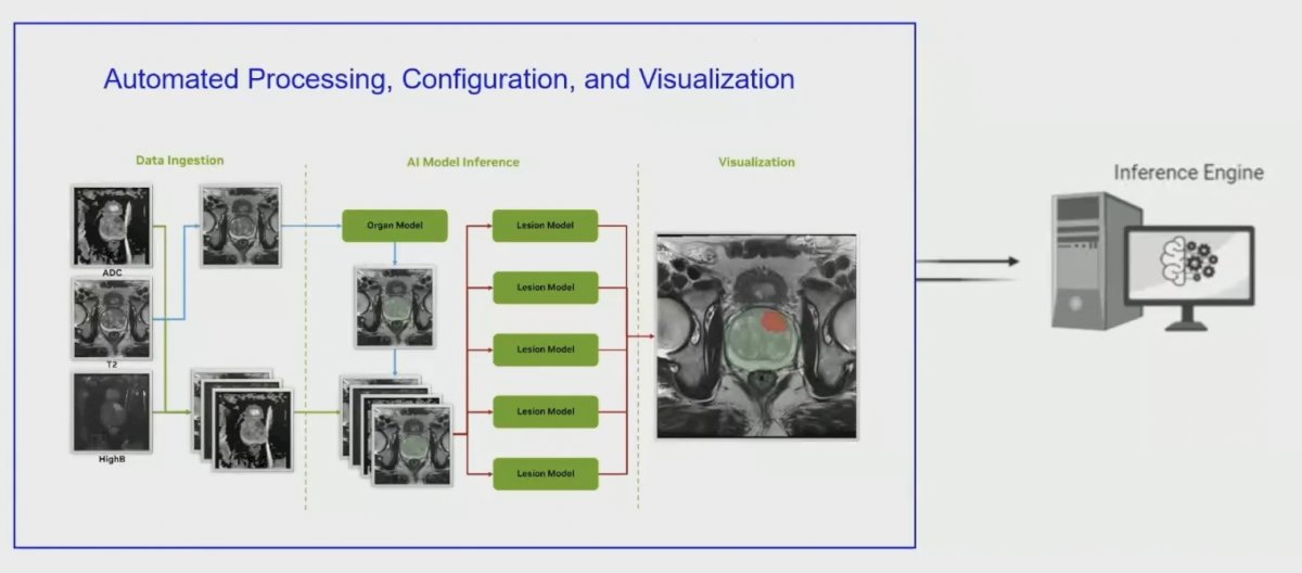 First, is a data induction stage, which is follow by automated processing, configuration, and visualization