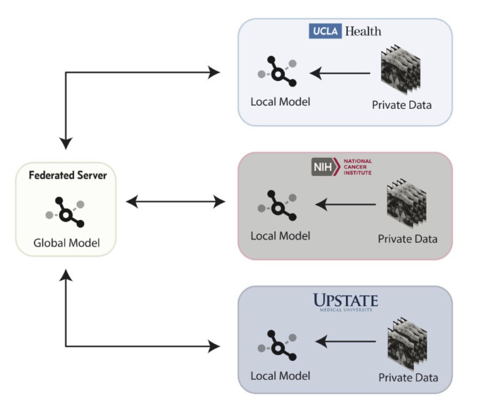 federated learning model exhibited superior performance and generalizability to the models trained at single institutions when evaluated on an outside challenge dataset