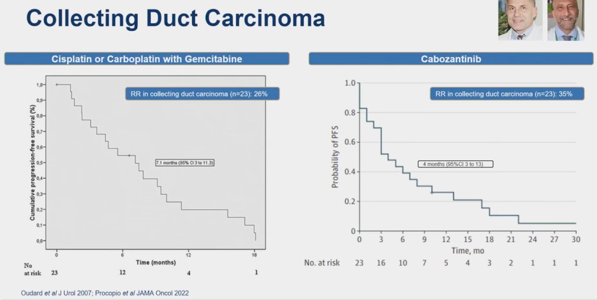 Collecting duct carcinoma