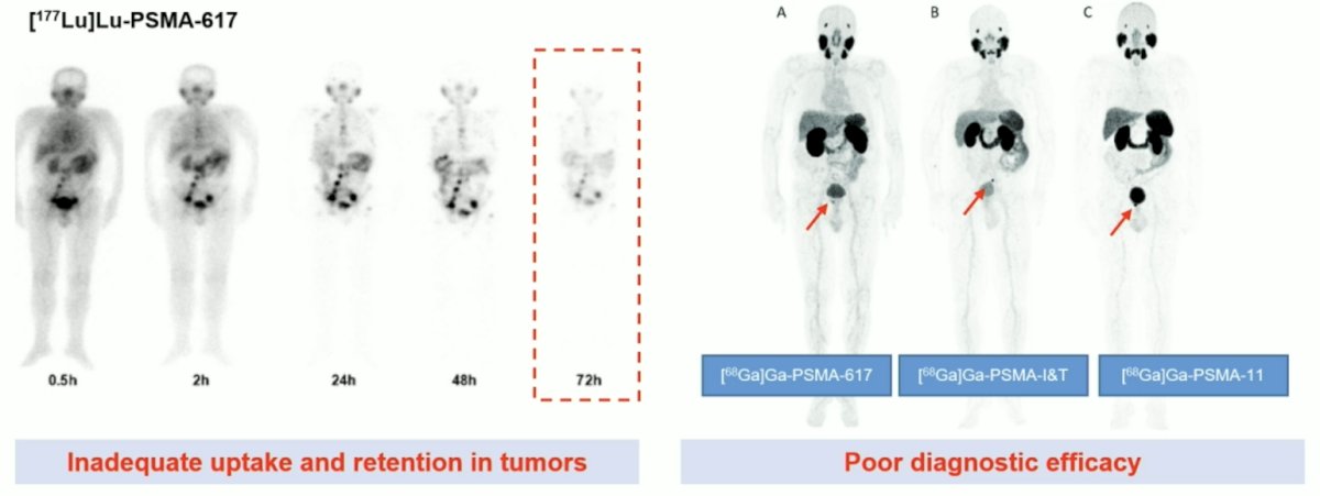 177Lu-PSMA-617 has inadequate uptake and retention in tumors, and poor diagnostic efficacy