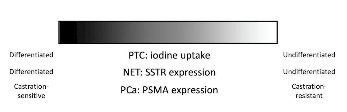 less expression (ie. iodine uptake, SSTR expression or PSMA expression) is also bad. This typically represents a movement from a differentiated, castration sensitive disease state to an undifferentiated and castration-resistant disease state