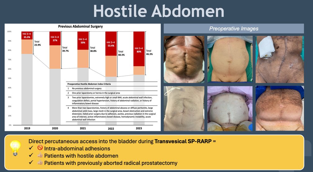 direct percutaneous access into the bladder