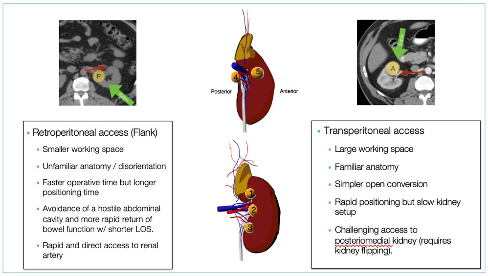 Transperitoneal access provides a large working space and familiar anatomy, while retroperitoneal access, although challenging due to its smaller working space and unfamiliar anatomy, offers faster operative times and quicker recovery for patients.