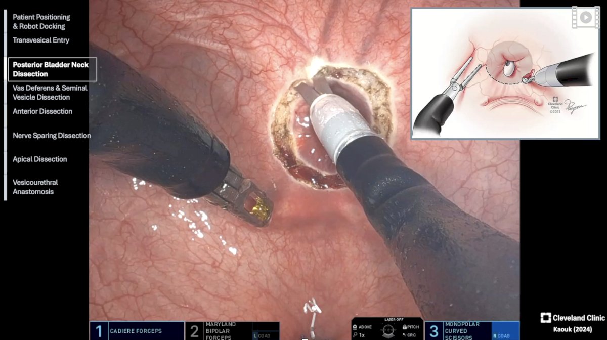 prefers not to change the camera position during the procedure, maintaining a consistent visual field.