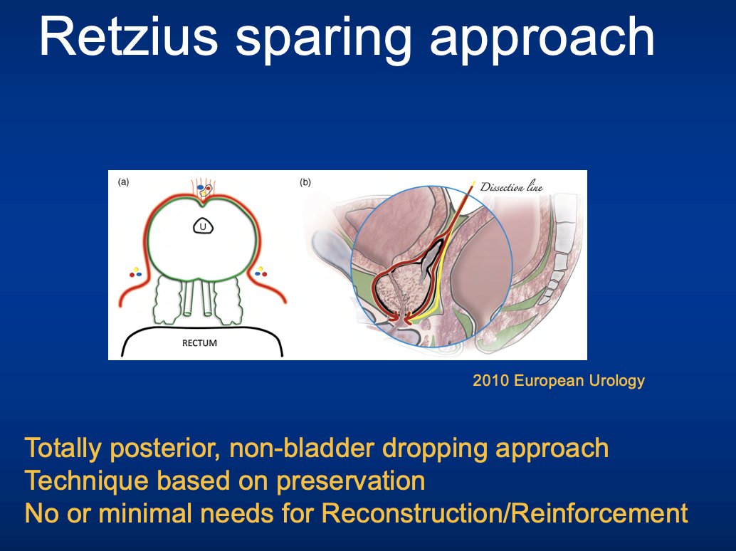 Retzius-Sparing Approach