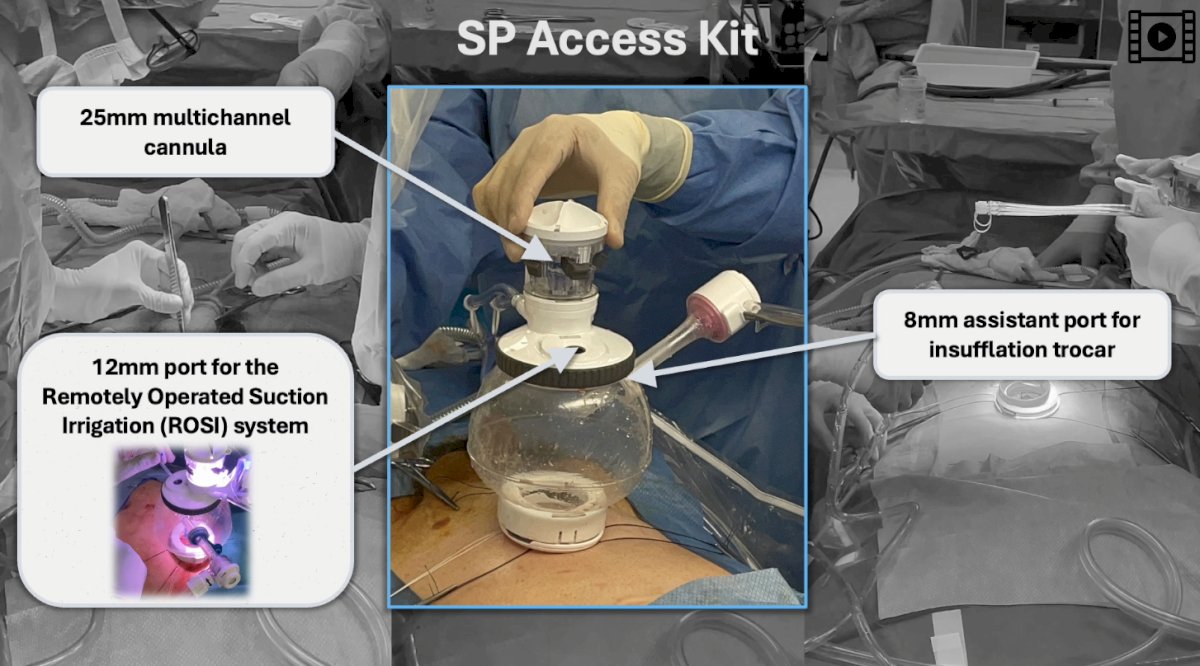 SP access kit