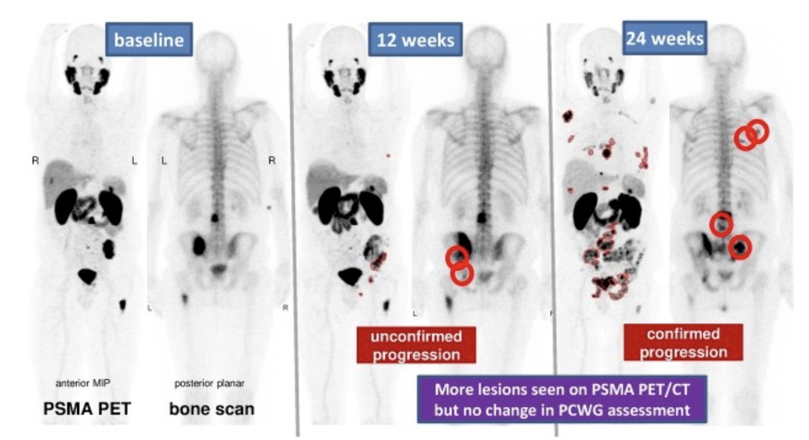 ESMO2024_PCWG3_0