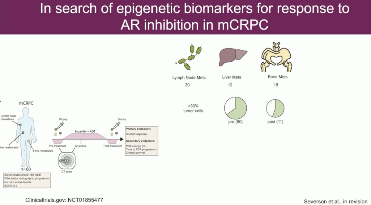 epigenetic features of lymph node, liver, and bone metastases