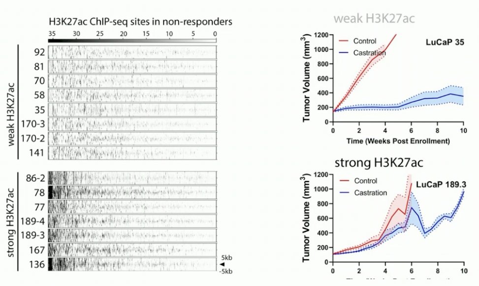 In tumors with weak H3K27ac signaling, there was an excellent response to castration. 