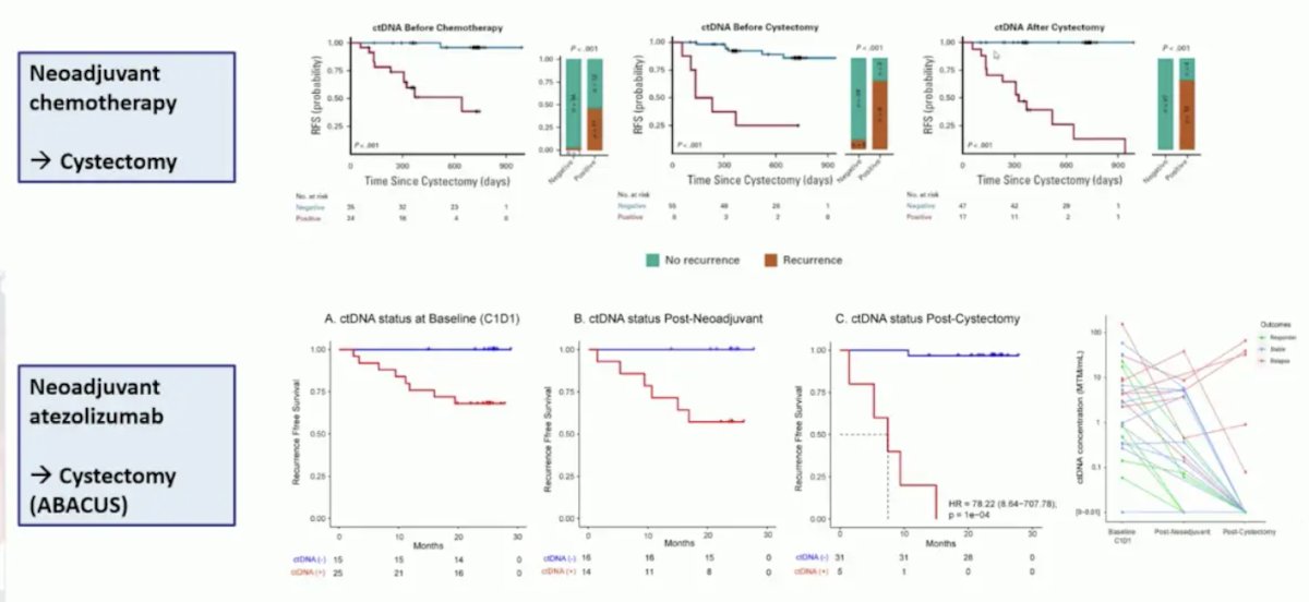 both neoadjuvant chemotherapy followed by cystectomy and for neoadjuvant atezolizumab followed by cystectomy (ABACUS), ctDNA was useful for monitoring response to therapy