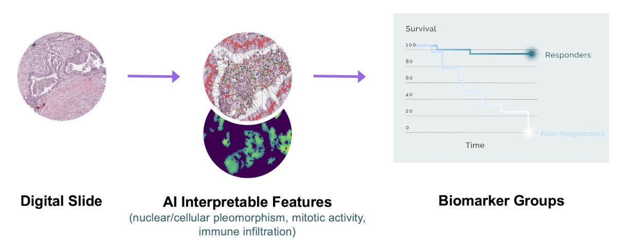 Pre-intravesical BCG TURBT-derived digital whole slide images and clinical data were obtained for BCG-naïve AUA high risk NMIBC cases diagnosed between 2007-2022 and treated with adequate BCG therapy from 12 academic centers