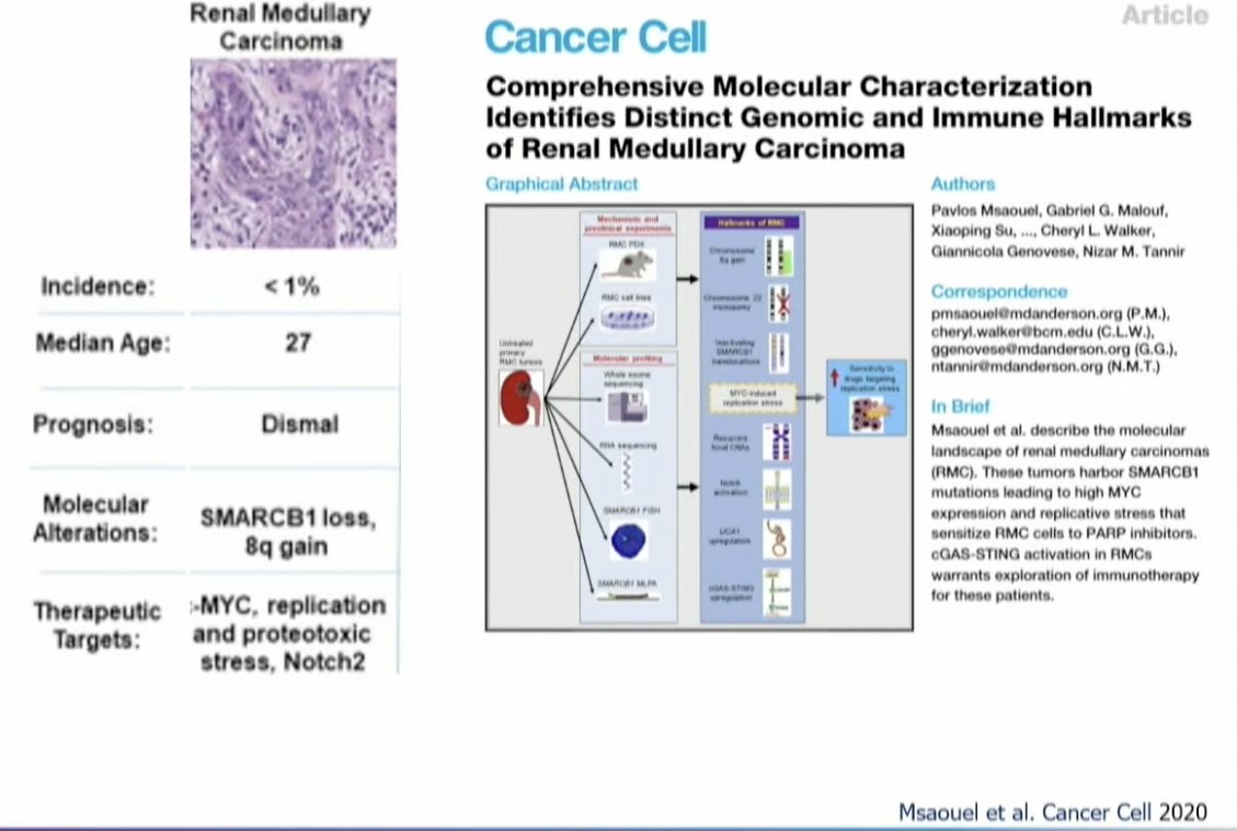 SABR for variant histology RCC