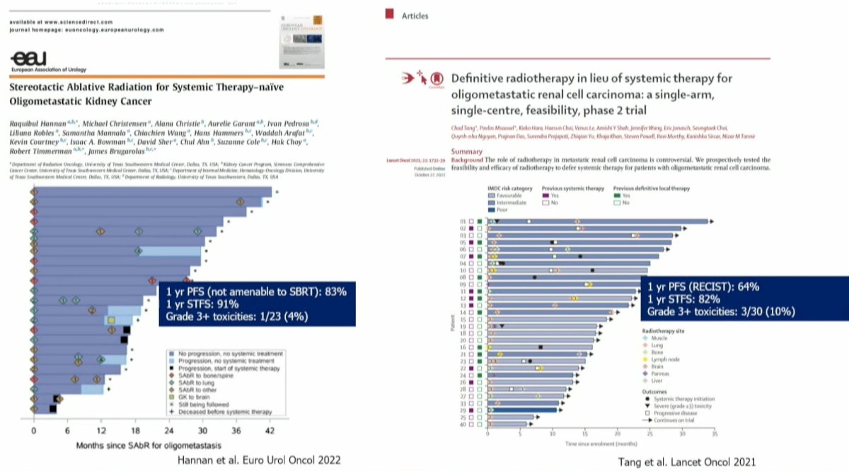 Concurrently, the group from UT Southwestern, led by Dr. Hannan, published the results of an analogous phase II trial that demonstrated similar results, with a 1-year progression-free survival of 83%, a 1-year systemic therapy-free survival of 91%, and grade ≥3 toxicity rate of 4%