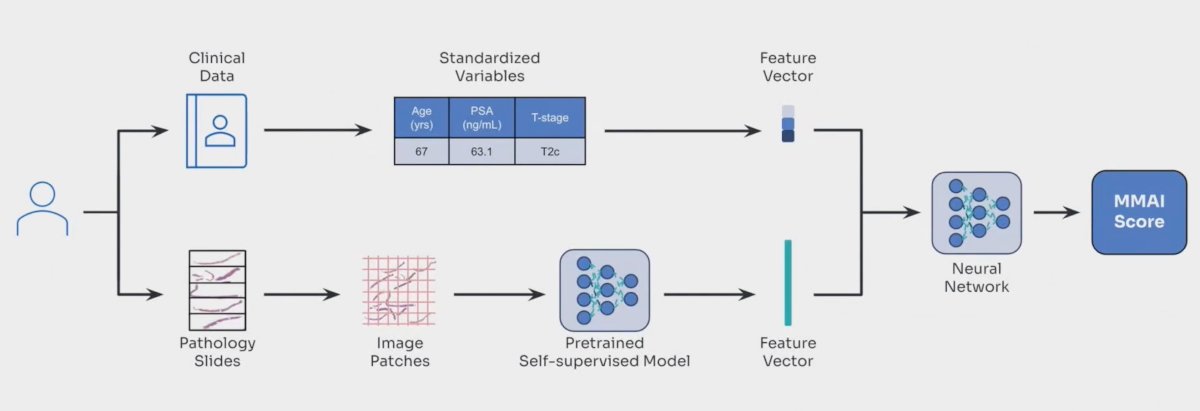 Oligometastatic castration sensitive prostate cancer is a heterogeneous disease. Recently, a MMAI algorithm (ArteraAI Prostate Test), which incorporates digital pathology and clinical information, has been shown to be prognostic in localized prostate cancer