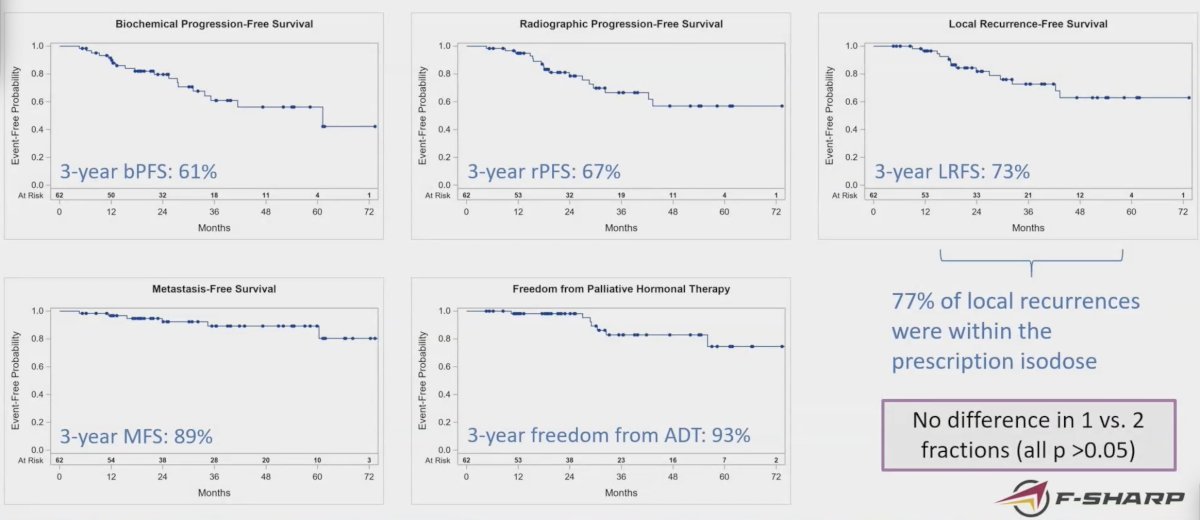 The 3-year biochemical progression free survival was 61%, radiographic progression-free survival was 67%, locoregional recurrence free survival was 73%, metastasis-free survival was 89%, and freedom from ADT was 93%