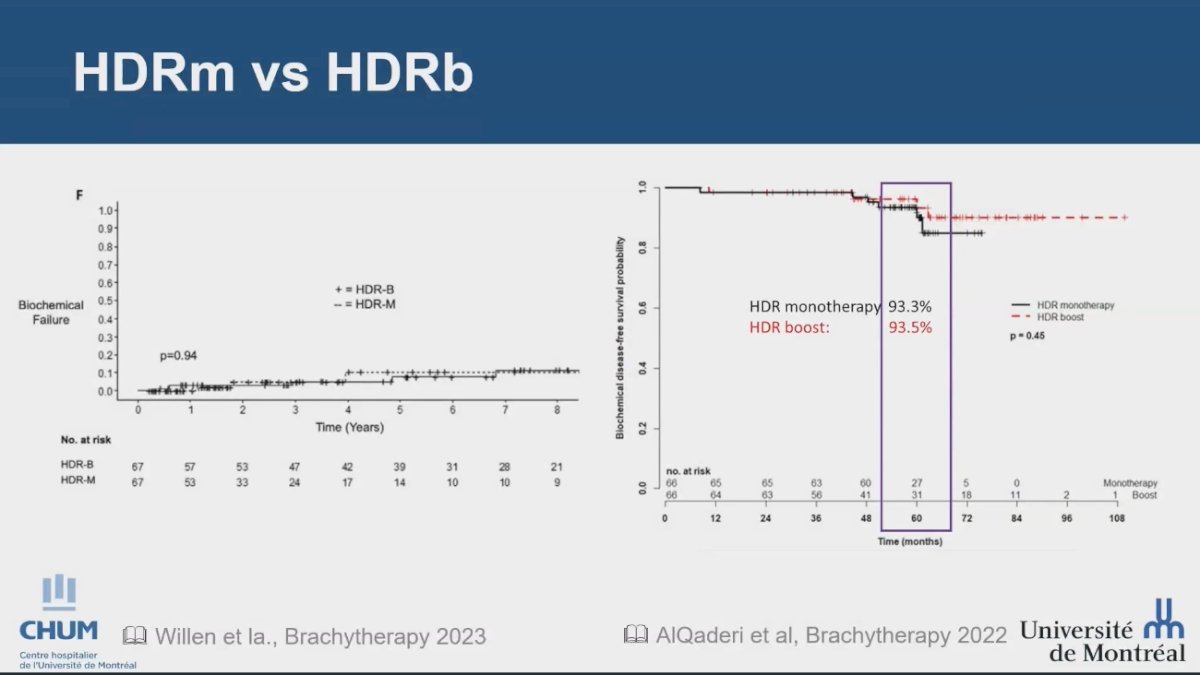 the role of brachytherapy as monotherapy, noting that there is increasing evidence suggesting that an HDR monotherapy approach may be equivalent to EBRT plus an HDR boost.