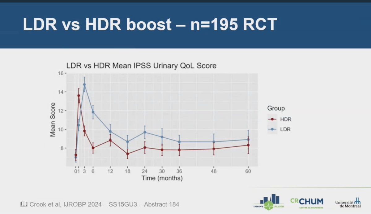  trial showed that urinary quality of life (QoL) associated with HDR BT improved over time, ultimately becoming equivalent to that of LDR after 18 months