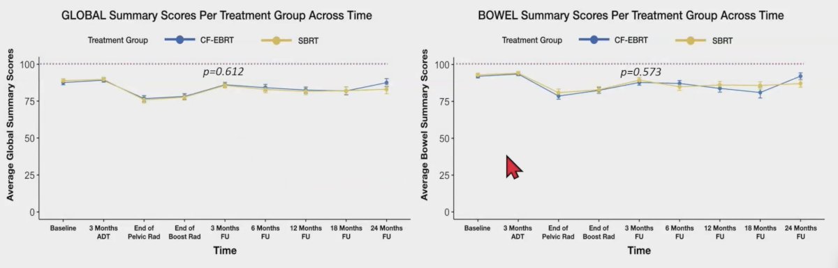 The mean follow up time was 18.5 (range: 6-24) months. Comparing conventional fractionation-external beam radiotherapy with stereotactic body radiotherapy three months after the treatment, there were no significant differences in the mean urinary 11.5 versus 8.6, p = 0.233; bowel 5.2 versus 6.4, p = 0.573; and global 8.3 versus 7.5, p = 0.612, EPIC scores