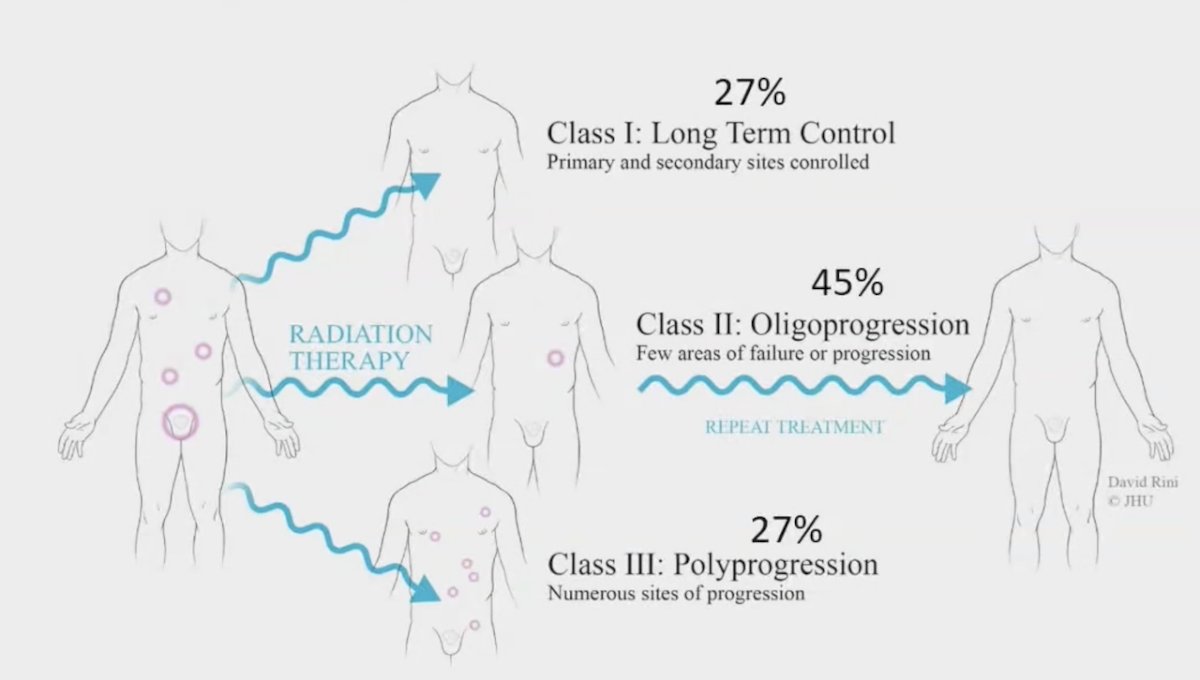 However, most patients (~86%) with bone metastatic oligometastatic hormone-sensitive prostate cancer recur with additional bone metastases following metastasis-directed therapy alone