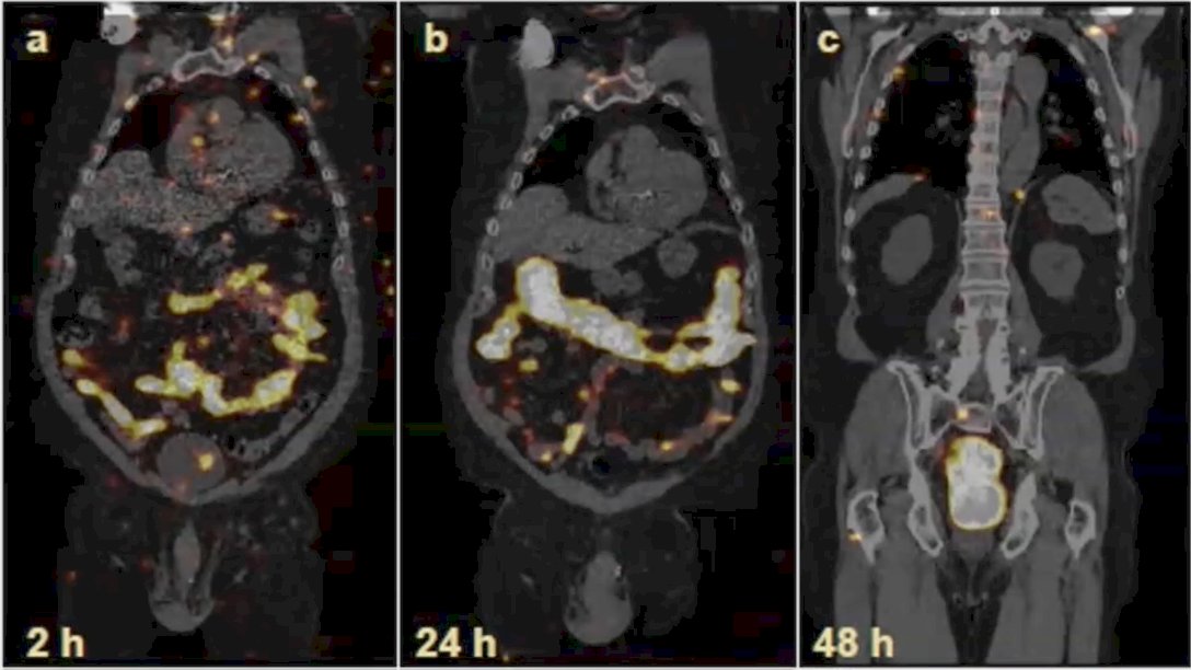 RAVENS, SPECT imaging