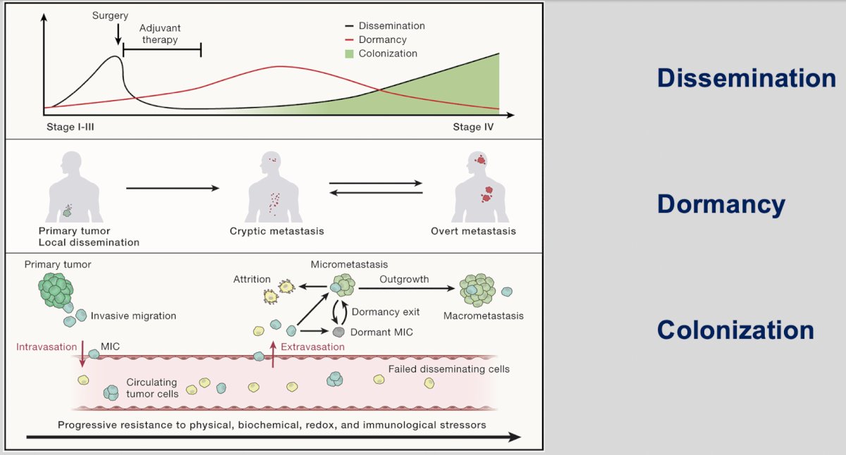  the theory of dissemination, dormancy, and colonization of metastatic cancer cells