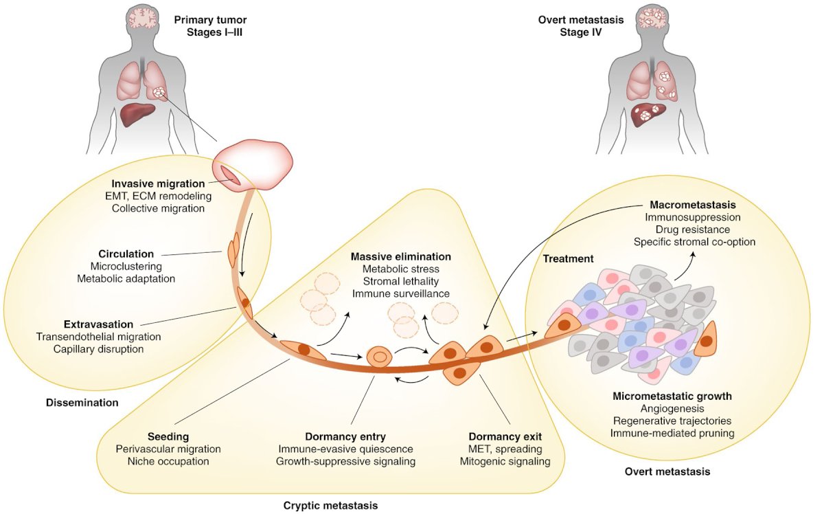 Dr. Palapattu notes that within micrometastatic disease, these cells have to survive, but also thrive and then exit dormancy, which is the point when cancer may be lethal