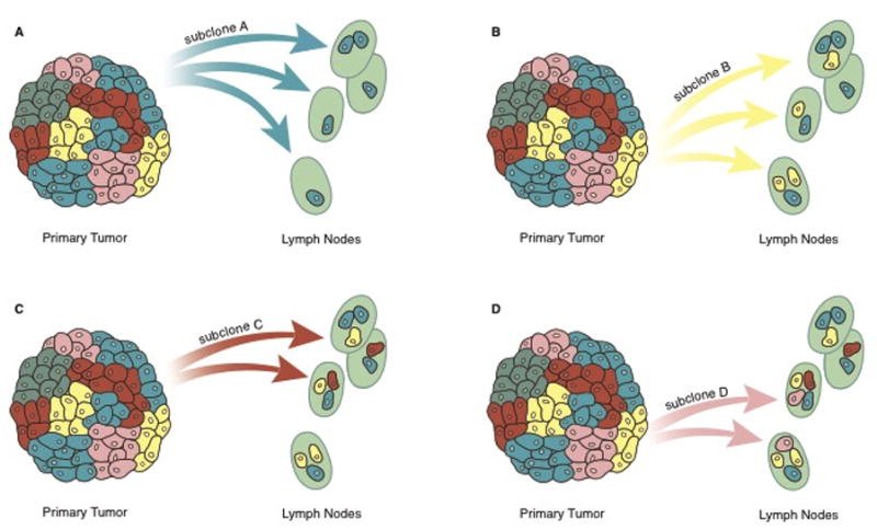 Dr. Palapattu notes that there is likely a clonal origin of metastases