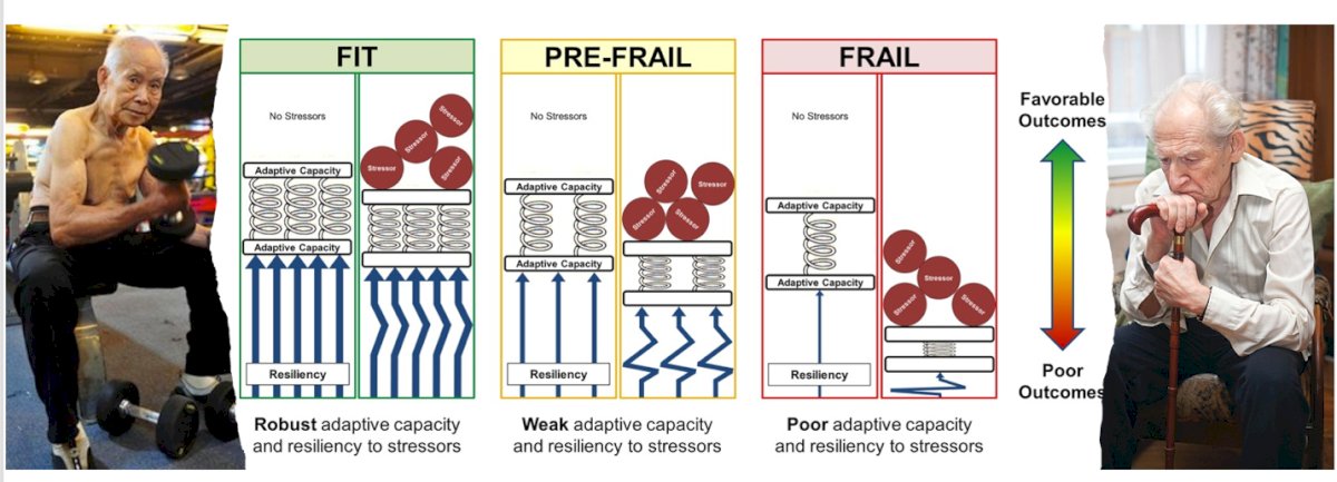 Dr. Psutka provided an example illustrating how different risk and reserve profiles can lead to varying outcomes when faced with the same level of stress, affecting the ability to withstand and recover from surgery.