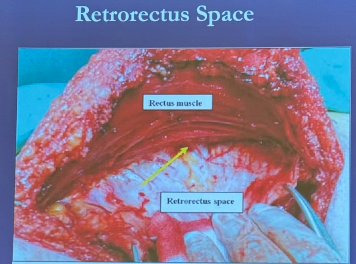 On the other hand, a Swedish randomized study included 242 patients who were randomized 1:1 to either conventional stoma construction (n = 124) or prophylactic mesh (n = 118). They used a Vypro mesh (10x10 cm), which is a synthetic mesh, placed in the retrorectus space