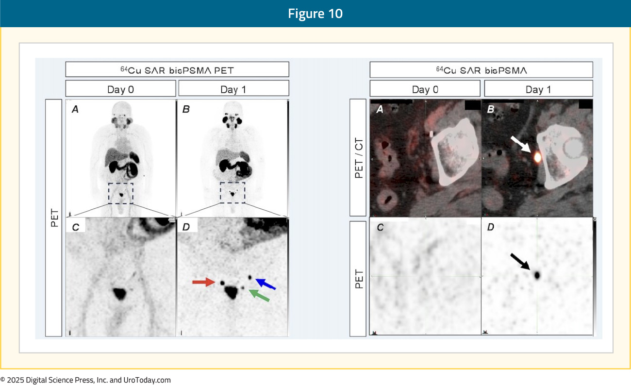 figure-10-PET-tracers-BRPC.jpg