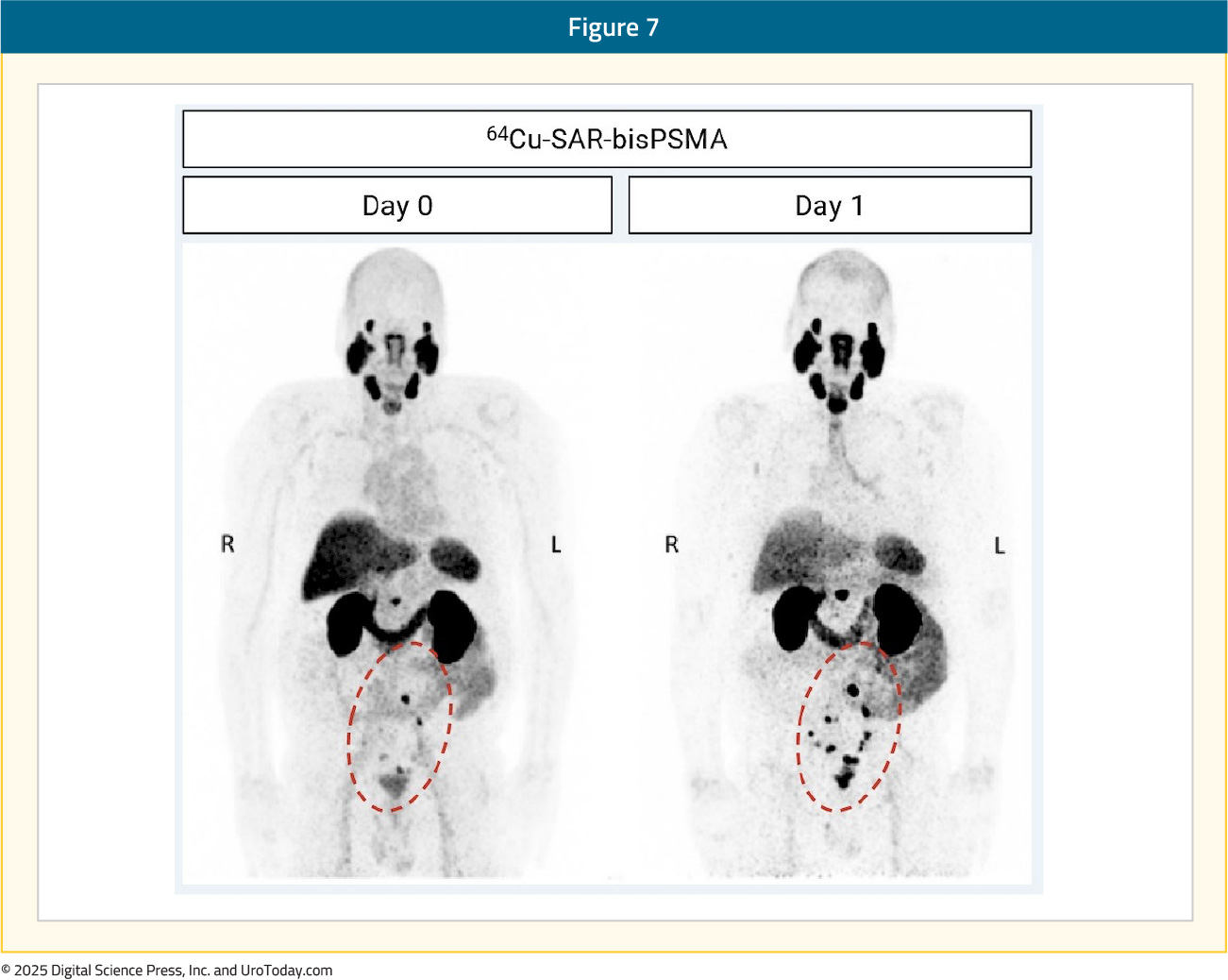 figure-7-PET-tracers-BRPC.jpg