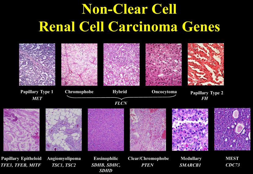 non clear cell rcc genes