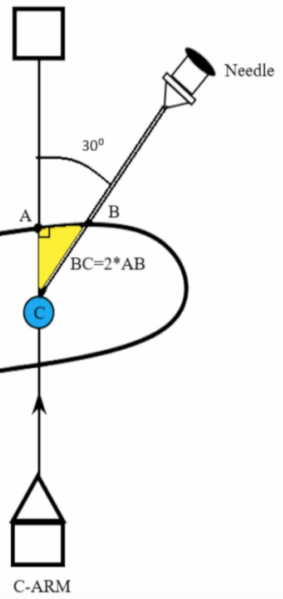 reaching target calyx C