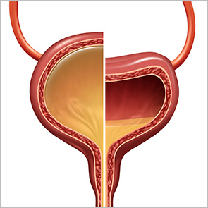 Pediatric Neurogenic Bladder: Causes, Symptoms, and Outlook
