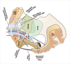 The biomechanics of uterine prolapse impact rectal intussusception