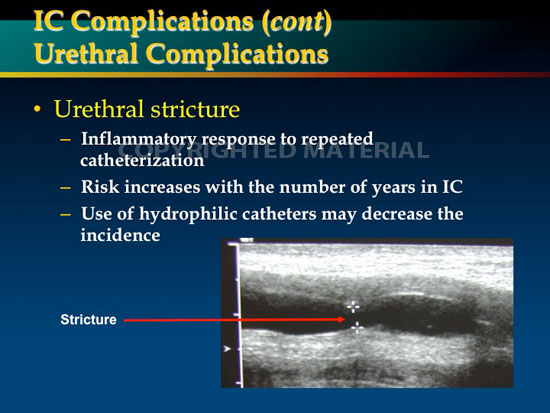 newman aua2012 ic slide27