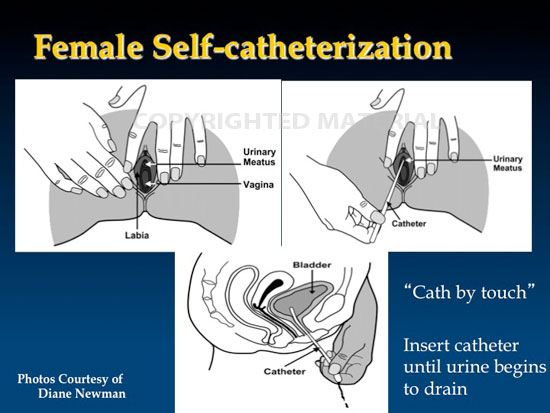 newman aua2012 ic slide36