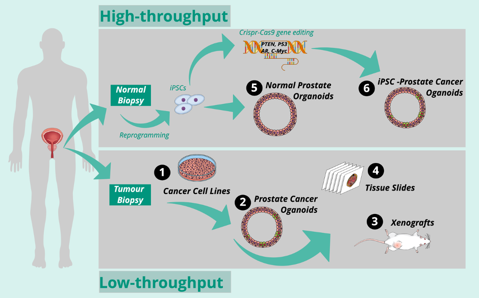 Engineering Prostate Cancer From Induced Pluripotent Stem Cells New Opportunities To Develop