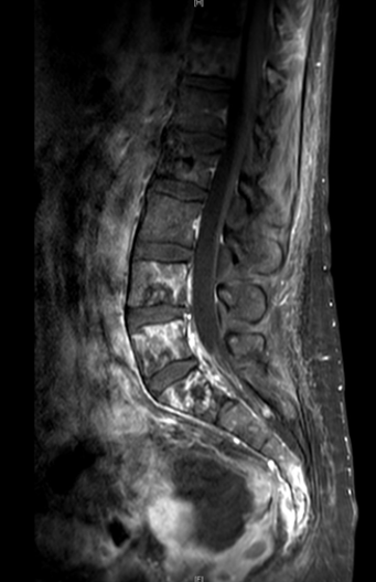 yu_asco21_figure3.png